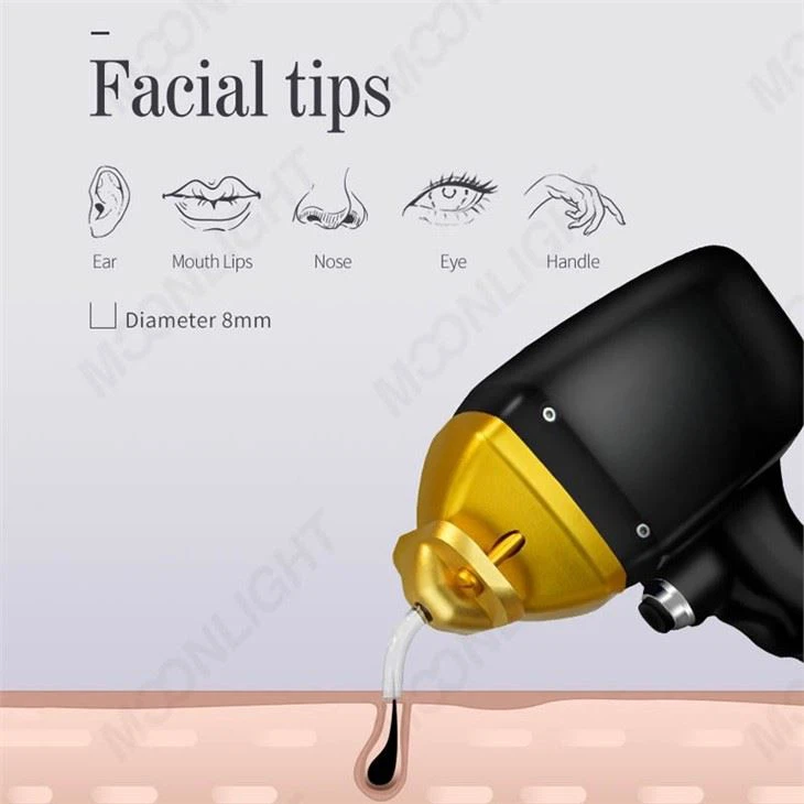 Diode Laser Hair Removal Soprano Titanium