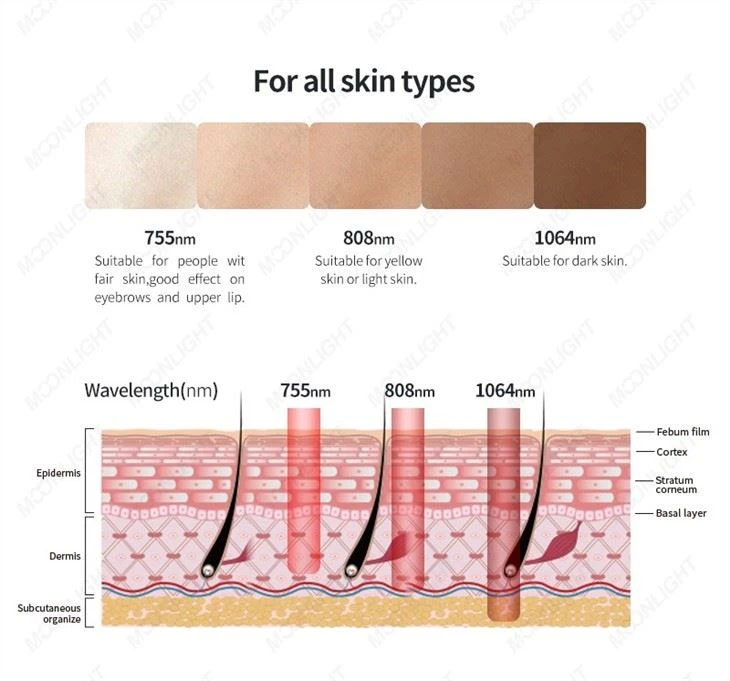 Medical Beauty Laser Soprano Titanium