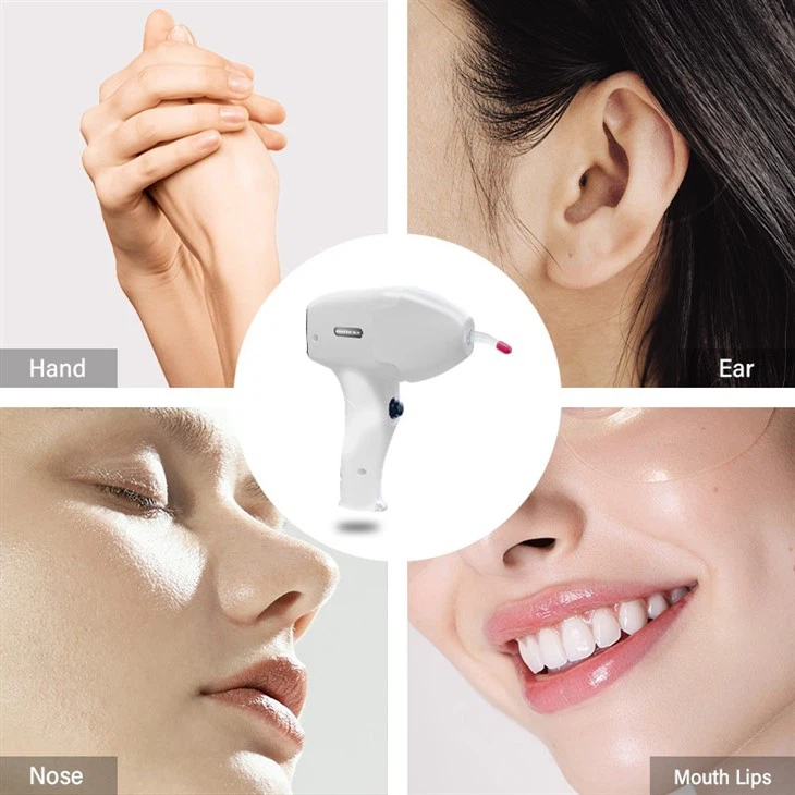 Soprano Titanium Diode Laser Hair Removal