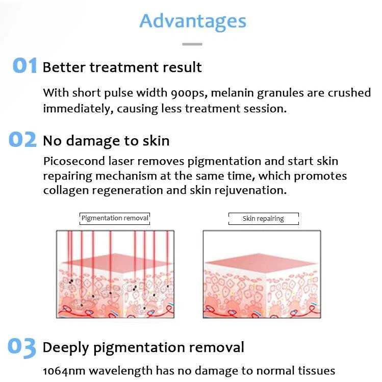 Desktop Tattoo Removal Machine