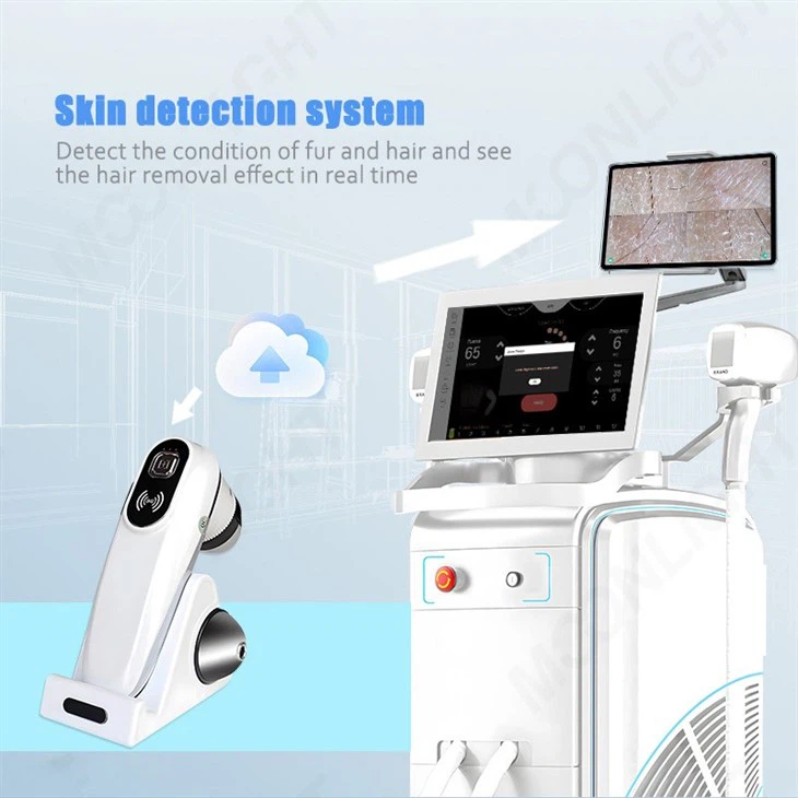 High Power Diode Laser Hair Removal Equipment