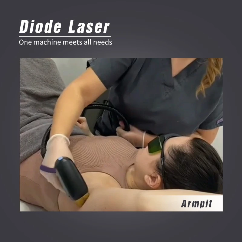 Laser Hair Removal Machine Supplier Price