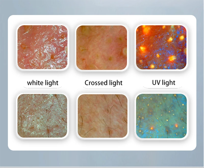 MNLT AI Skin & Hair Analyzer high quality