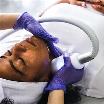 Tighten Skin Cryoslimming Cryoskin arcápoló gép
